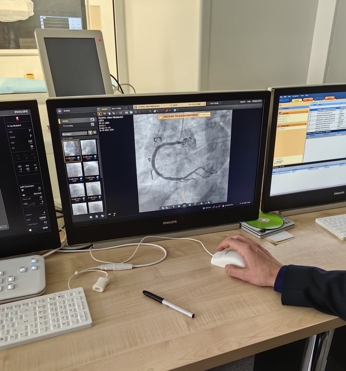 Мариупольцев после инфаркта будут наблюдать в специальном кабинете